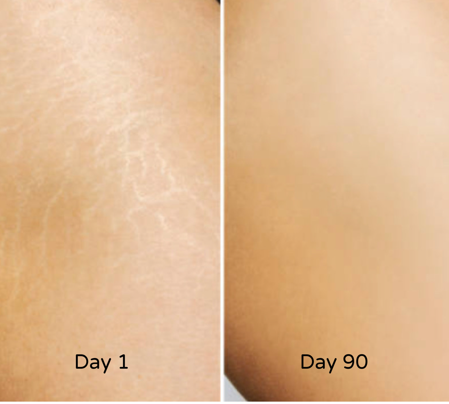 HoneyBee Venom Elixir Serum