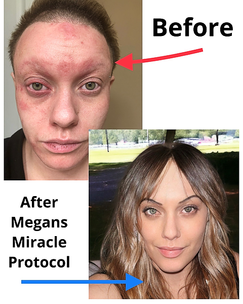 Is Megan's Miracle Protocol Right for You